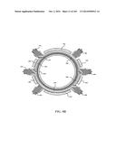 Tissure Closure Device and Method diagram and image