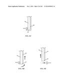 Tissure Closure Device and Method diagram and image