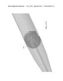 Tissure Closure Device and Method diagram and image