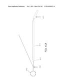 Tissure Closure Device and Method diagram and image