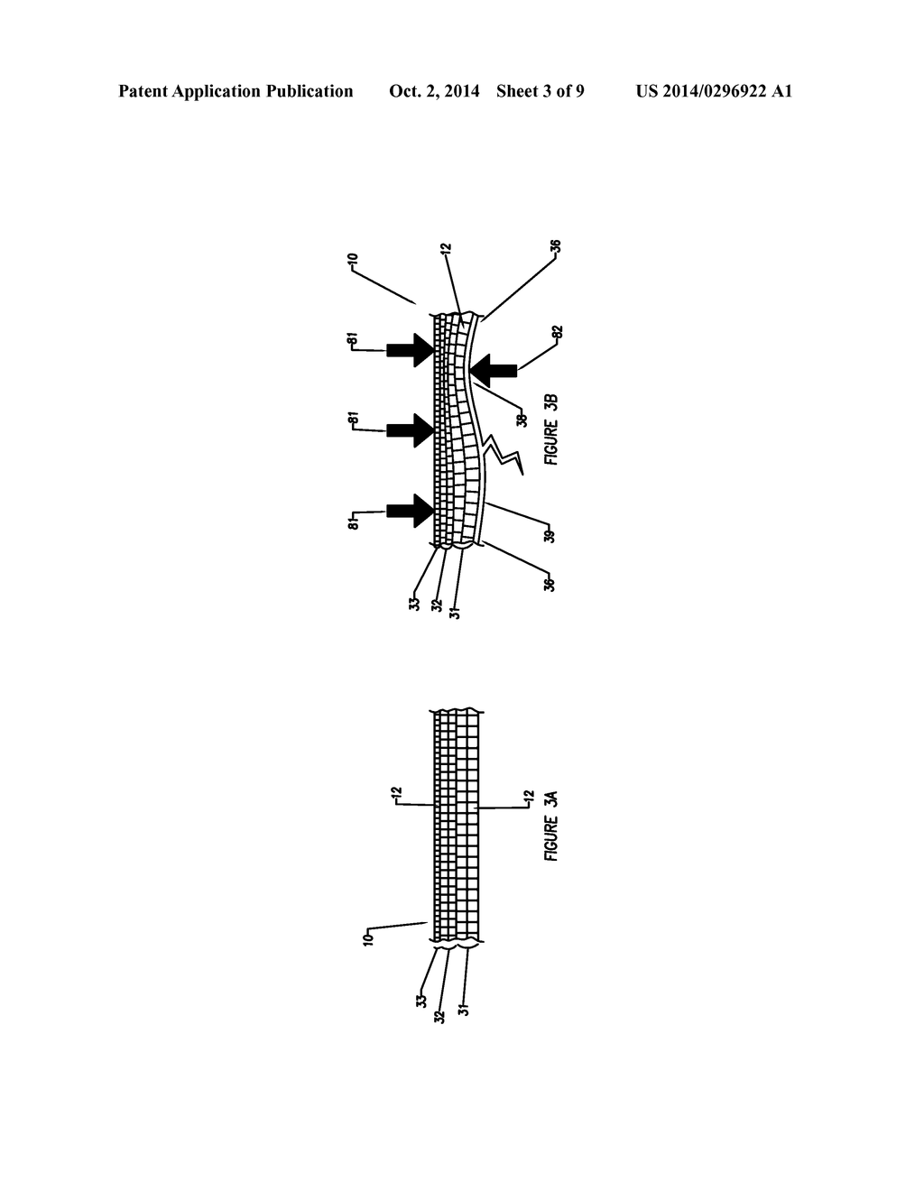 COMPLIANT OSTEOSYNTHESIS FIXATION PLATE - diagram, schematic, and image 04