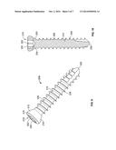 Bone Plate Having Combination Locking and Compression Screw Holes diagram and image