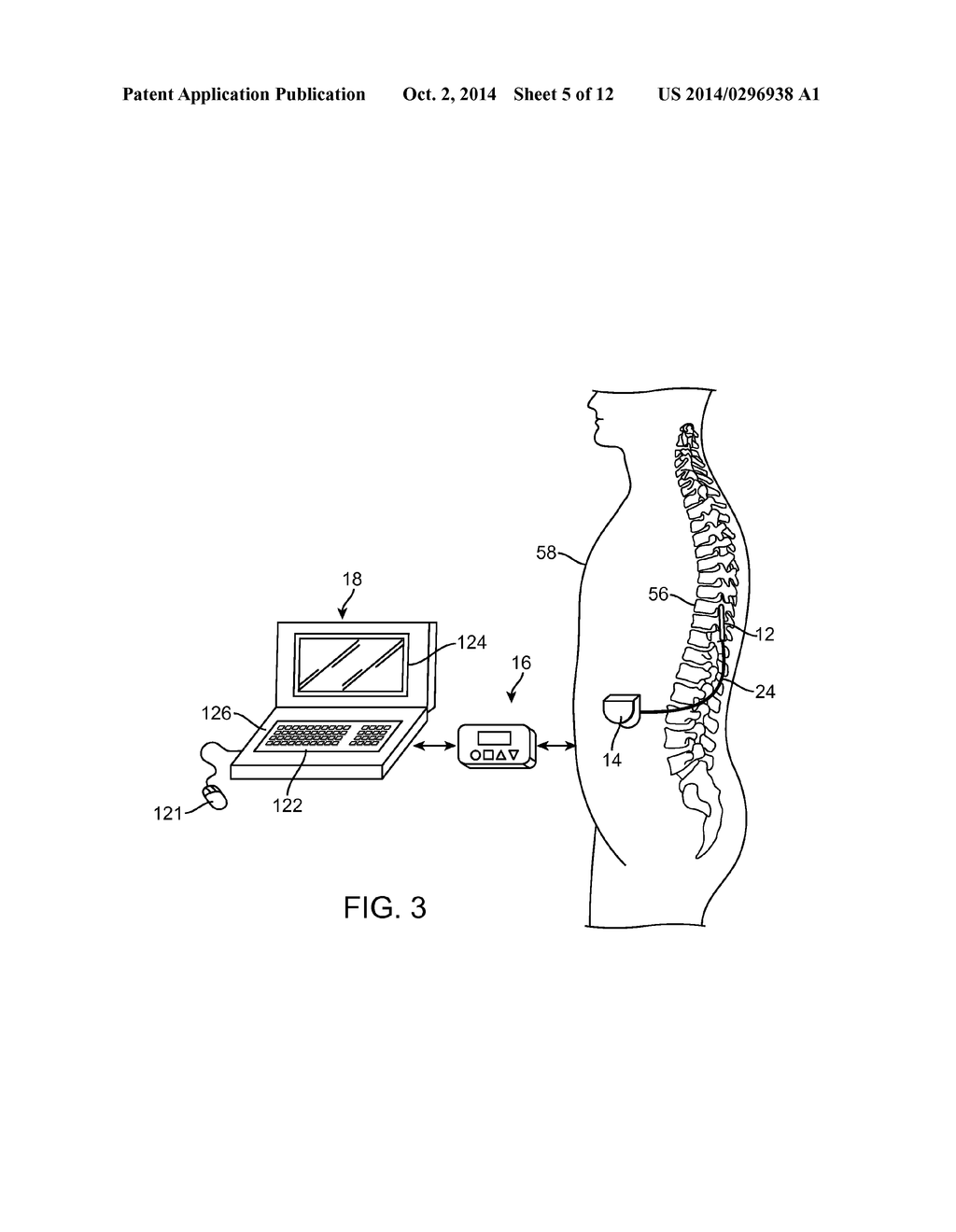 SYSTEM AND METHOD FOR CONNECTING DEVICES TO A NEUROSTIMULATOR - diagram, schematic, and image 06