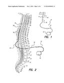 NEURAL STIMULATION SYSTEM PROVIDING AUTO ADJUSTMENT OF STIMULUS OUTPUT AS     A FUNCTION OF SENSED IMPEDANCE diagram and image