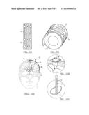 Neural Interface System diagram and image