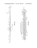 Medical Electrical Stimulation Lead Including Expandable Coiled Fixation     Element diagram and image