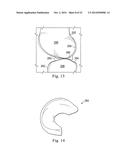 Tensioned Meniscus Prosthetic Devices and Associated Methods diagram and image