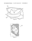 Tensioned Meniscus Prosthetic Devices and Associated Methods diagram and image