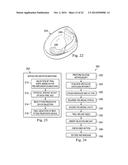 Tensioned Meniscus Prosthetic Devices and Associated Methods diagram and image