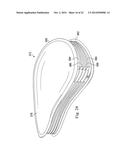 Tensioned Meniscus Prosthetic Devices and Associated Methods diagram and image