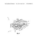 Prosthetic Spinal Disc Replacement and Methods Thereof diagram and image