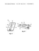 Prosthetic Spinal Disc Replacement and Methods Thereof diagram and image