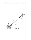 Prosthetic Spinal Disc Replacement and Methods Thereof diagram and image