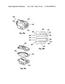 Prosthetic Spinal Disc Replacement and Methods Thereof diagram and image