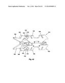 Prosthetic Spinal Disc Replacement and Methods Thereof diagram and image