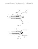 SHOULDER IMPLANT FOR SIMULATING A BURSA diagram and image