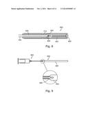 SHOULDER IMPLANT FOR SIMULATING A BURSA diagram and image