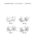 HIP & KNEE JOINT ASSEMBLIES INCORPORATING DEBRIS COLLECTION ARCHITECTURE     BETWEEN THE BALL AND SEAT INTERFACE diagram and image