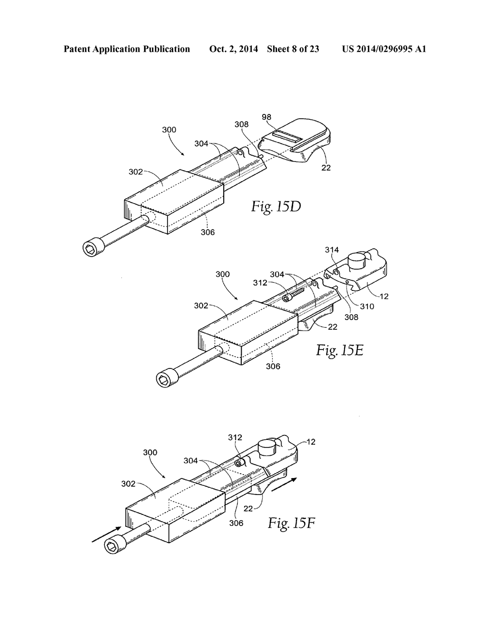 ANKLE REPLACEMENT SYSTEM - diagram, schematic, and image 09