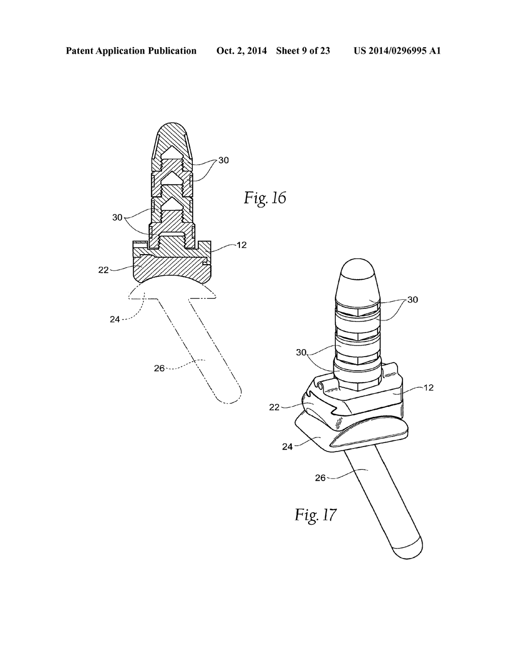 ANKLE REPLACEMENT SYSTEM - diagram, schematic, and image 10