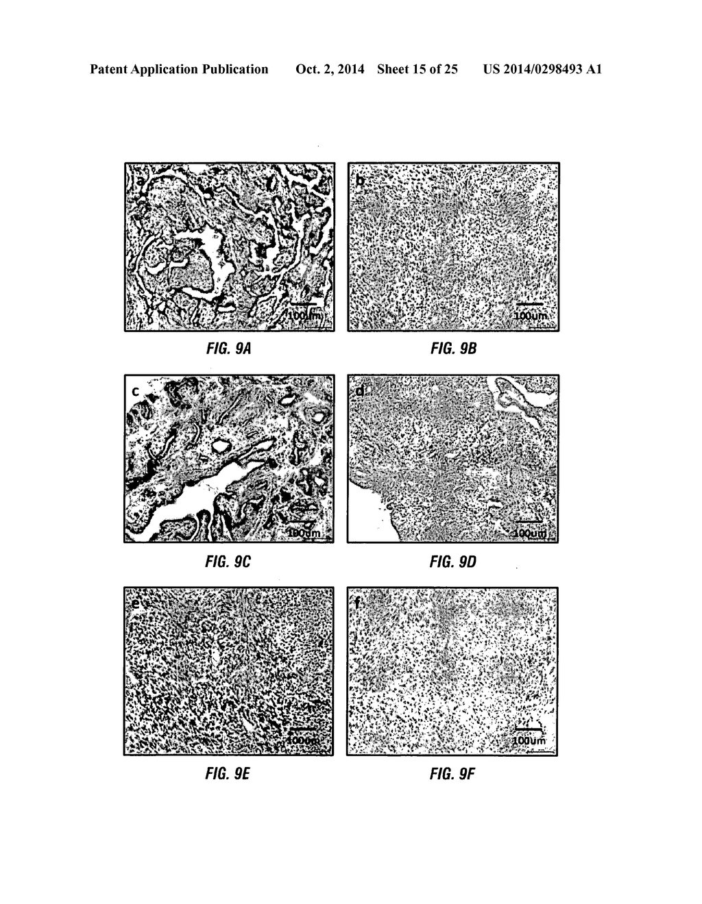 PIK3CA H1047R Knock-In Non-Human Animal Breast Cancer Model - diagram, schematic, and image 16