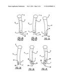 SYSTEM FOR CALCULATING FOREFOOT WEDGE ANGLE TO CORRECT     PRONATION/SUPINATION diagram and image