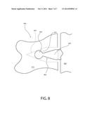 Kinematically Coupled Gear Assemblies and Methods of Manufacturing the     Same diagram and image