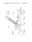 POWER OPERATED ROTARY KNIFE WITH DISPOSABLE BLADE SUPPORT ASSEMBLY diagram and image