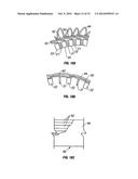 Expandable Device for Use in a Well Bore diagram and image