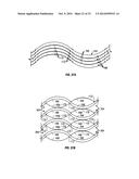 Expandable Device for Use in a Well Bore diagram and image