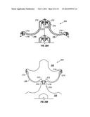 Expandable Device for Use in a Well Bore diagram and image