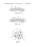 DECREASED ADHESION PRESSURE VESSEL FOR BAG-TYPE FILTRATION SYSTEMS diagram and image