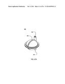 BLOOD TREATMENT SYSTEMS AND METHODS diagram and image