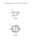 BLOOD TREATMENT SYSTEMS AND METHODS diagram and image