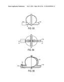 BLOOD TREATMENT SYSTEMS AND METHODS diagram and image