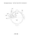 BLOOD TREATMENT SYSTEMS AND METHODS diagram and image