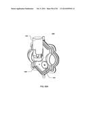 BLOOD TREATMENT SYSTEMS AND METHODS diagram and image