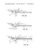 SHEET RETENTION DEVICE diagram and image