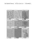 MASKLESS IMAGING OF DENSE SAMPLES USING MULTI-HEIGHT LENSFREE MICROSCOPE diagram and image