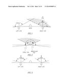 METHOD AND SYSTEM FOR TREATMENT OF VISUAL IMPAIRMENT diagram and image