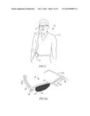 METHOD AND SYSTEM FOR TREATMENT OF VISUAL IMPAIRMENT diagram and image