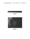 X-RAY IMAGING WITH X-RAY MARKERS THAT PROVIDE ADJUNCT INFORMATION BUT     PRESERVE IMAGE QUALITY diagram and image