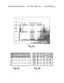 X-RAY IMAGING WITH X-RAY MARKERS THAT PROVIDE ADJUNCT INFORMATION BUT     PRESERVE IMAGE QUALITY diagram and image