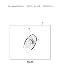 Enrollment Using Synthetic Fingerprint Image and Fingerprint Sensing     Systems diagram and image