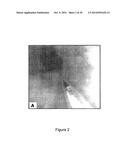 METHODS AND SYSTEMS FOR OPTICAL IMAGING OR EPITHELIAL LUMINAL ORGANS BY     BEAM SCANNING THEREOF diagram and image