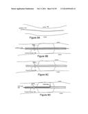 METHODS AND SYSTEMS FOR OPTICAL IMAGING OR EPITHELIAL LUMINAL ORGANS BY     BEAM SCANNING THEREOF diagram and image