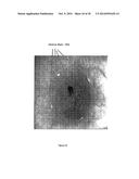 METHODS AND SYSTEMS FOR OPTICAL IMAGING OR EPITHELIAL LUMINAL ORGANS BY     BEAM SCANNING THEREOF diagram and image