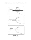 METHODS AND SYSTEMS FOR OPTICAL IMAGING OR EPITHELIAL LUMINAL ORGANS BY     BEAM SCANNING THEREOF diagram and image