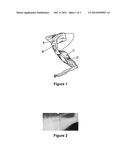 BOTULINUM TOXIN FORMULATION diagram and image