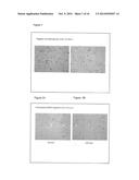 INHIBITORS OF METASTASIS diagram and image